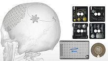 Non-absorbable cranial fixation system Fast Flap