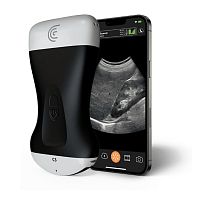 Hand-held ultrasound system C3 HD3for multipurpose ultrasound imagingfor gynecological and obstetric ultrasound imagingfor abdominal and pelvic ultrasound imaging