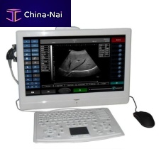 On-platform, tabletop ultrasound system SIFULTRAS-4.1for gynecological and obstetric ultrasound imagingfor urology ultrasound imagingB/W
