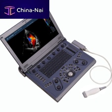 Color doppler ultrasound system C6 portablefor multipurpose ultrasound imagingB/W