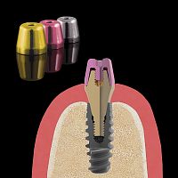 Multi-unit abutment healing cap
