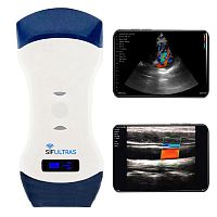 Hand-held ultrasound system SIFULTRAS-5.42for multipurpose ultrasound imagingfor abdominal and pelvic ultrasound imagingfor emergency medicine ultrasound imaging