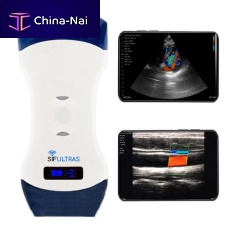 Hand-held ultrasound system SIFULTRAS-5.42for multipurpose ultrasound imagingfor abdominal and pelvic ultrasound imagingfor emergency medicine ultrasound imaging