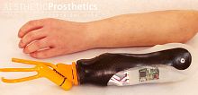 Myo-electric hand prosthesis hook clampadult