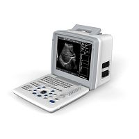 Portable ultrasound system S300for multipurpose ultrasound imagingB/W12-inch
