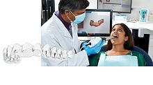 Clear dental aligner SureSmile®