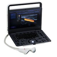 Portable ultrasound system SonidoSmart Profor musculoskeletal ultrasound imagingB/Wcolor doppler