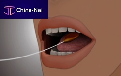 Non-surgical intragastric balloon Elipse