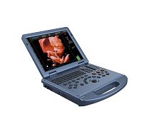 Portable ultrasound system DW-L50for multipurpose ultrasound imagingfor gynecological and obstetric ultrasound imagingfor cardiovascular ultrasound imaging