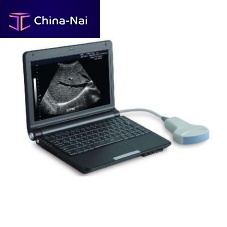 Portable ultrasound system PT3000D1for multipurpose ultrasound imagingB/W