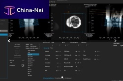 MRI software MR-GUI Promanagementacquisitionpost-processing
