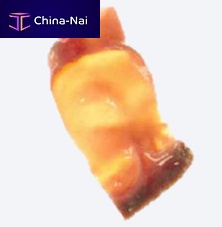 Cardiac tissue matrix CryoPatch® SGvascularallograft