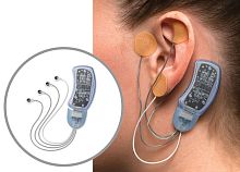 Transcutaneous neurostimulator Bridgefor auricular vagus nerve stimulation