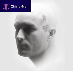 Non-absorbable cranial fixation system