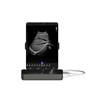Portable ultrasound system Cloudfor multipurpose ultrasound imagingfor emergency medicine ultrasound imagingfor breast ultrasound imaging
