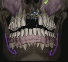 AI software IconiX surgerydentalanatomy