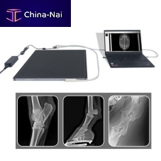 Multipurpose radiography flat panel detector YSFPD-V1717Xportable17 x 17