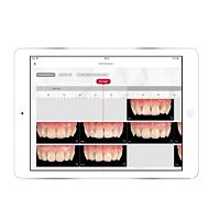 Dental iOS application ToothScout for dental prosthesis designfor smartphonesfor tablet PC