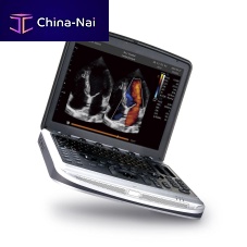 Portable ultrasound system SonoBook 9for multipurpose ultrasound imagingfor gynecological and obstetric ultrasound imagingfor cardiovascular ultrasound imaging