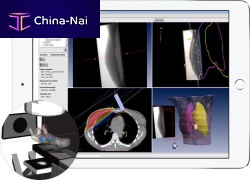 Radiation therapy software module EPIgray®radiation dose monitoring