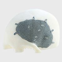Custom-made cranial implant