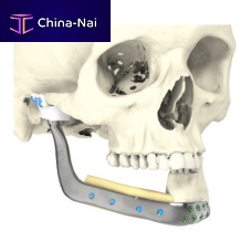 Custom-made mandibular implant non-absorbable