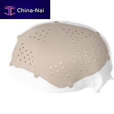 Custom-made cranial implant