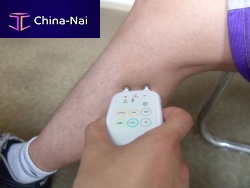 Transcutaneous neurostimulator 2001Pfor peripheral nerve stimulation