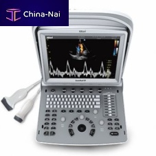 Portable ultrasound system SonoRad K9for multipurpose ultrasound imagingB/Wcolor doppler