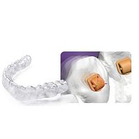 Dental aligner