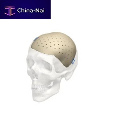 Custom-made cranial implant Cranial iD