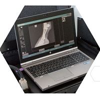 Veterinary radiography acquisition system MUSICA DRportable