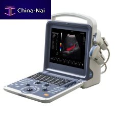 Portable ultrasound system M7 PLUSfor multipurpose ultrasound imagingfor gynecological and obstetric ultrasound imagingfor abdominal and pelvic ultrasound imaging