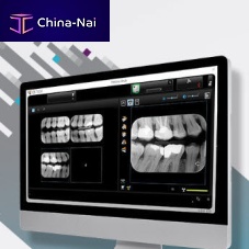 Dental software for dental imagingdiagnostictreatment