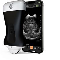 Hand-held ultrasound system C7 HD3for abdominal and pelvic ultrasound imagingfor urology ultrasound imagingfor cardiovascular ultrasound imaging