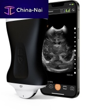 Hand-held ultrasound system C7 HD3for abdominal and pelvic ultrasound imagingfor urology ultrasound imagingfor cardiovascular ultrasound imaging