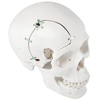 Non-absorbable cranial fixation system LeForte Neuro 0.3