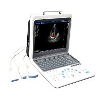 Portable ultrasound system TH-5100for multipurpose ultrasound imagingcolor dopplerbuilt-in console