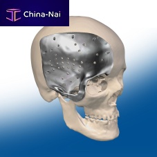 Custom-made cranial implant
