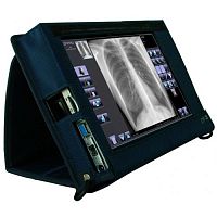 Radiography acquisition system Primo W add-onportable