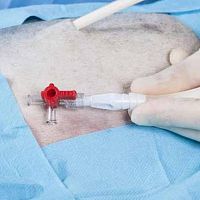 Medical valve 00120001bluered