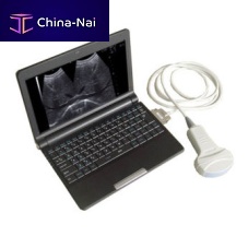 Multipurpose ultrasound imaging system Arterial DopplerportableB/Wcolor doppler