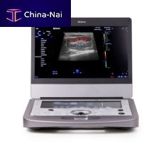 Portable veterinary ultrasound system AX3 VET Edanmultipurpose