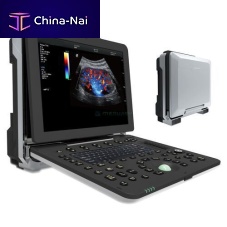 Portable ultrasound system DW-P8for gynecological and obstetric ultrasound imagingfor multipurpose ultrasound imagingfor cardiovascular ultrasound imaging