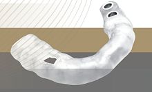 Dental implantology surgical guide