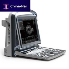 Portable veterinary ultrasound system Chison ECO1multipurposefor equinesfor sheep