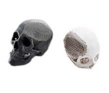 Custom-made cranial implant JCI