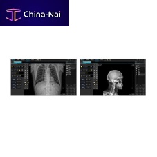Radiology software printingDICOM viewing