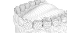 Transparent dental aligner