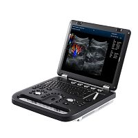 Portable ultrasound system M60 for multipurpose ultrasound imagingB/Wcolor doppler